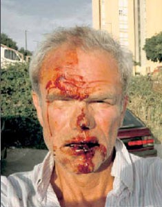 Dat krijg je als je in Nederland wat terugzegt. Vaak loopt het erger af..